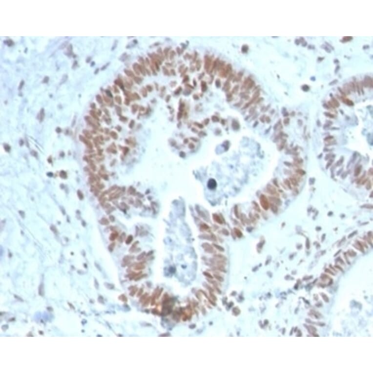 Immunohistochemistry - Anti-ZNF704 Antibody [PCRP-ZNF704-3C10] - BSA and Azide free (A278366) - Antibodies.com