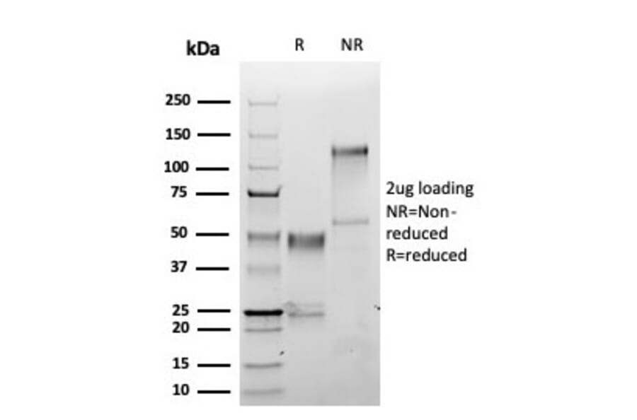 SDS-PAGE - Anti-S100A1 Antibody [S100A1/6374R] - BSA and Azide free (A278369) - Antibodies.com