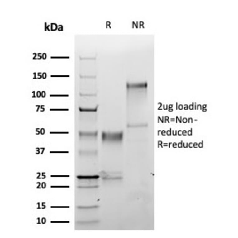 SDS-PAGE - Anti-S100A1 Antibody [S100A1/6374R] - BSA and Azide free (A278369) - Antibodies.com