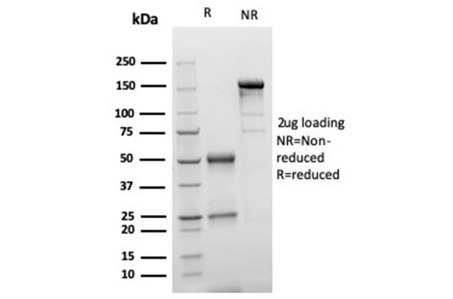 SDS-PAGE - Anti-S100 beta Antibody [S100B/4149] - BSA and Azide free (A278370) - Antibodies.com
