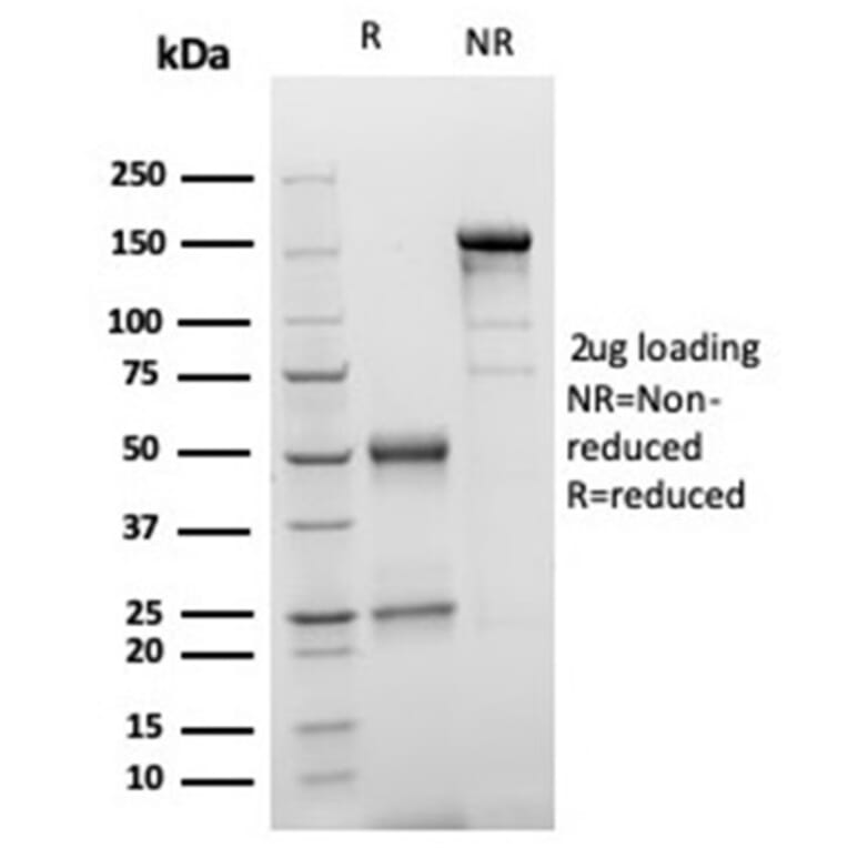 SDS-PAGE - Anti-S100 beta Antibody [S100B/4149] - BSA and Azide free (A278370) - Antibodies.com