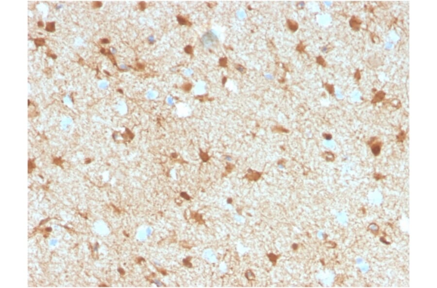 Immunohistochemistry - Anti-S100 beta Antibody [S100B/4149] - BSA and Azide free (A278370) - Antibodies.com