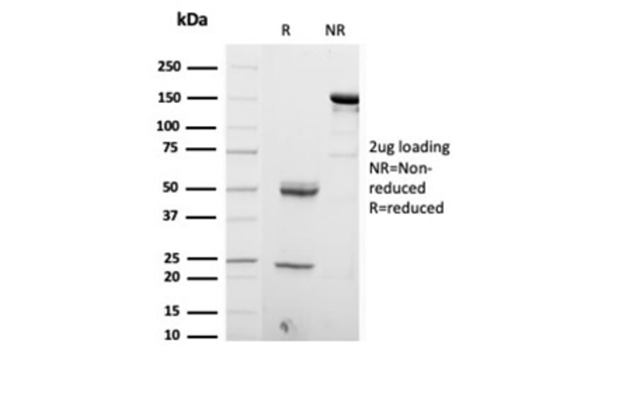 SDS-PAGE - Anti-S100 beta Antibody [S100B/4153] - BSA and Azide free (A278371) - Antibodies.com