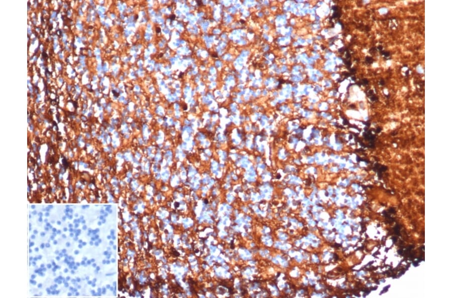 Immunohistochemistry - Anti-S100 beta Antibody [S100B/4153] - BSA and Azide free (A278371) - Antibodies.com