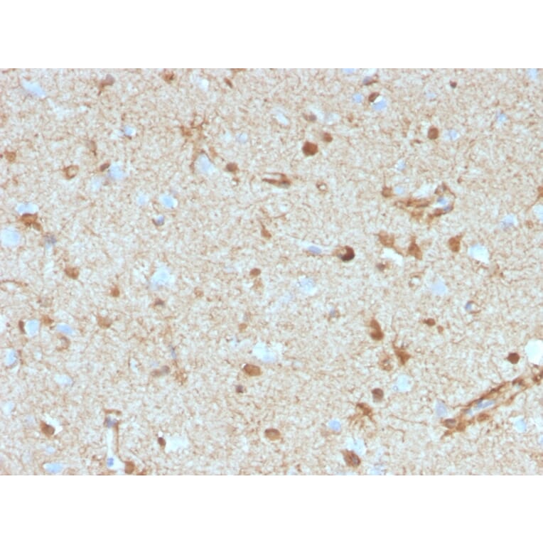 Immunohistochemistry - Anti-S100 beta Antibody [S100B/4153] - BSA and Azide free (A278371) - Antibodies.com