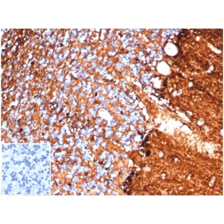 Immunohistochemistry - Anti-S100 beta Antibody [S100B/4138] - BSA and Azide free (A278372) - Antibodies.com