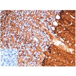 Immunohistochemistry - Anti-S100 beta Antibody [S100B/4138] - BSA and Azide free (A278372) - Antibodies.com