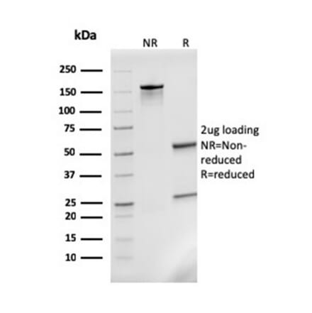 SDS-PAGE - Anti-MCP2 Antibody [CCL8/3311] - BSA and Azide free (A278373) - Antibodies.com