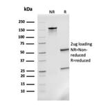 SDS-PAGE - Anti-MCP2 Antibody [CCL8/3311] - BSA and Azide free (A278373) - Antibodies.com
