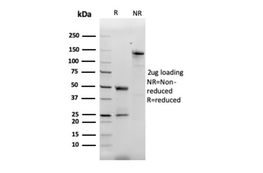 SDS-PAGE - Anti-MCP2 Antibody [CCL8/3312] - BSA and Azide free (A278374) - Antibodies.com