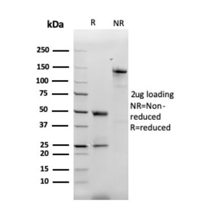SDS-PAGE - Anti-MCP2 Antibody [CCL8/3312] - BSA and Azide free (A278374) - Antibodies.com