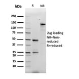SDS-PAGE - Anti-MCP2 Antibody [CCL8/3312] - BSA and Azide free (A278374) - Antibodies.com