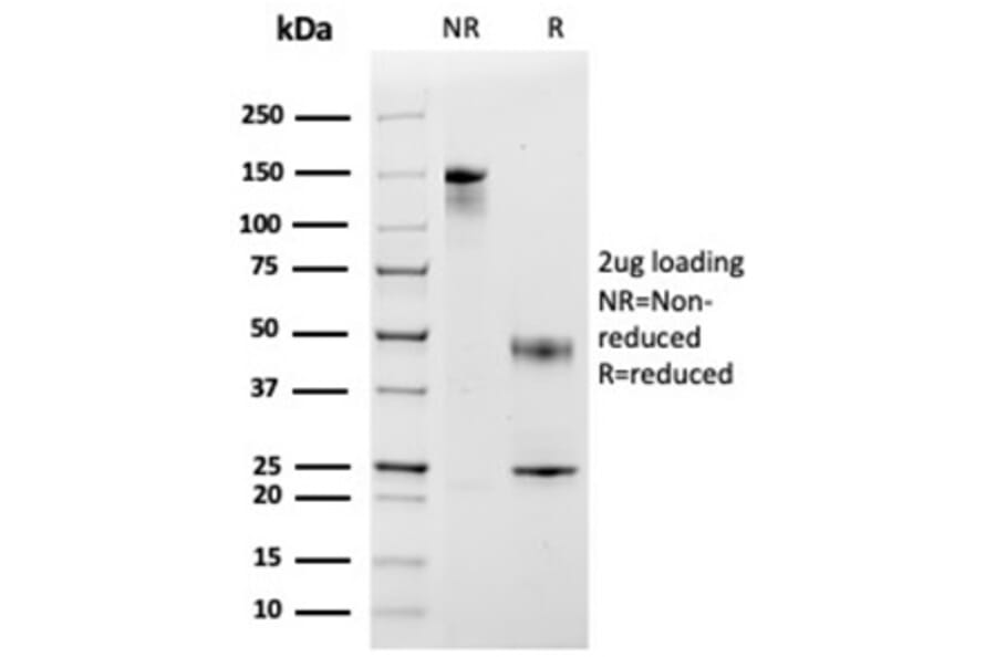 SDS-PAGE - Anti-MCP2 Antibody [CCL8/3683] - BSA and Azide free (A278375) - Antibodies.com
