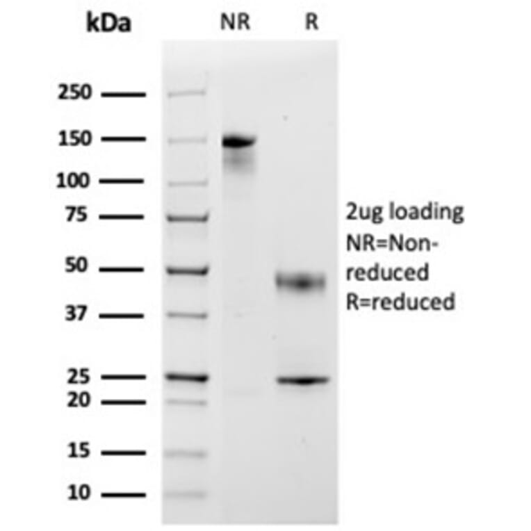 SDS-PAGE - Anti-MCP2 Antibody [CCL8/3683] - BSA and Azide free (A278375) - Antibodies.com