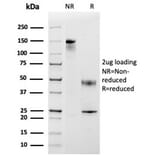 SDS-PAGE - Anti-MCP2 Antibody [CCL8/3683] - BSA and Azide free (A278375) - Antibodies.com