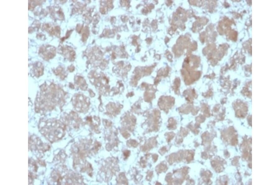 Immunohistochemistry - Anti-MCP2 Antibody [CCL8/3683] - BSA and Azide free (A278375) - Antibodies.com