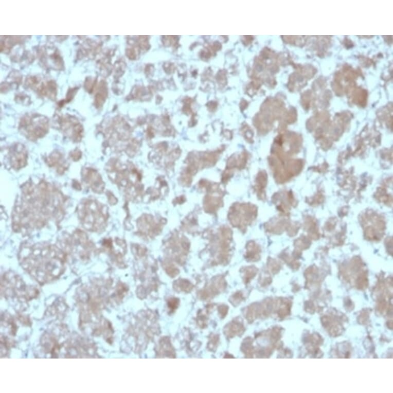 Immunohistochemistry - Anti-MCP2 Antibody [CCL8/3683] - BSA and Azide free (A278375) - Antibodies.com