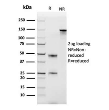 SDS-PAGE - Anti-MCP2 Antibody [CCL8/3686] - BSA and Azide free (A278376) - Antibodies.com