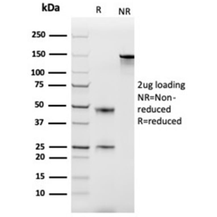 SDS-PAGE - Anti-MCP2 Antibody [CCL8/3686] - BSA and Azide free (A278376) - Antibodies.com