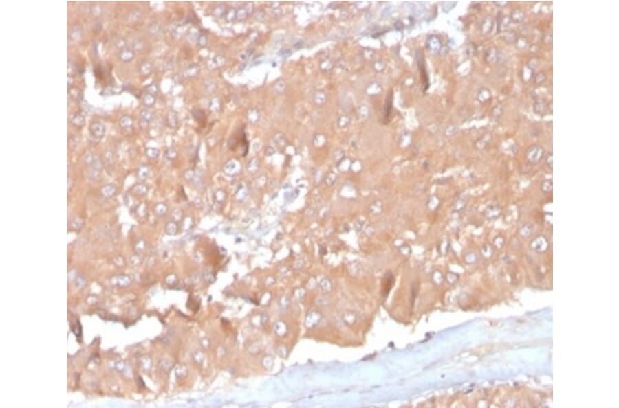 Immunohistochemistry - Anti-MCP2 Antibody [CCL8/3686] - BSA and Azide free (A278376) - Antibodies.com