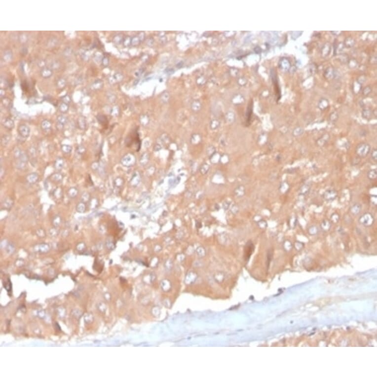 Immunohistochemistry - Anti-MCP2 Antibody [CCL8/3686] - BSA and Azide free (A278376) - Antibodies.com