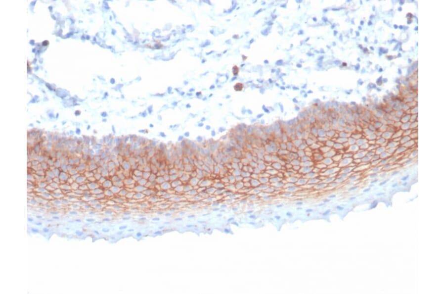 Immunohistochemistry - Anti-Syndecan 1 Antibody [SDC1/7180] - BSA and Azide free (A278377) - Antibodies.com