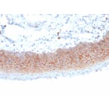 Immunohistochemistry - Anti-Syndecan 1 Antibody [SDC1/7180] - BSA and Azide free (A278377) - Antibodies.com