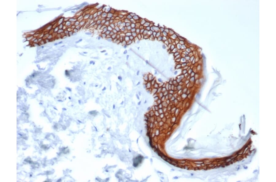 Immunohistochemistry - Anti-Syndecan 1 Antibody [SDC1/7180] - BSA and Azide free (A278377) - Antibodies.com