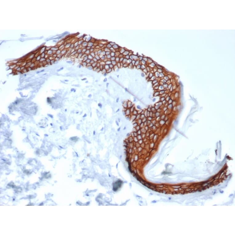 Immunohistochemistry - Anti-Syndecan 1 Antibody [SDC1/7180] - BSA and Azide free (A278377) - Antibodies.com