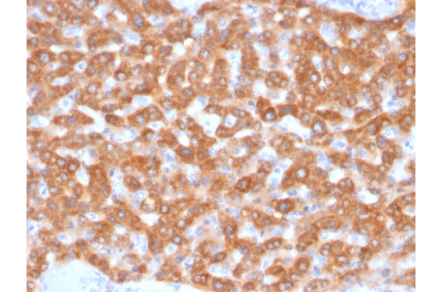 Immunohistochemistry - Anti-SDHB Antibody [SDHB/2126] - BSA and Azide free (A278378) - Antibodies.com