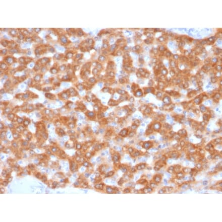 Immunohistochemistry - Anti-SDHB Antibody [SDHB/2126] - BSA and Azide free (A278378) - Antibodies.com