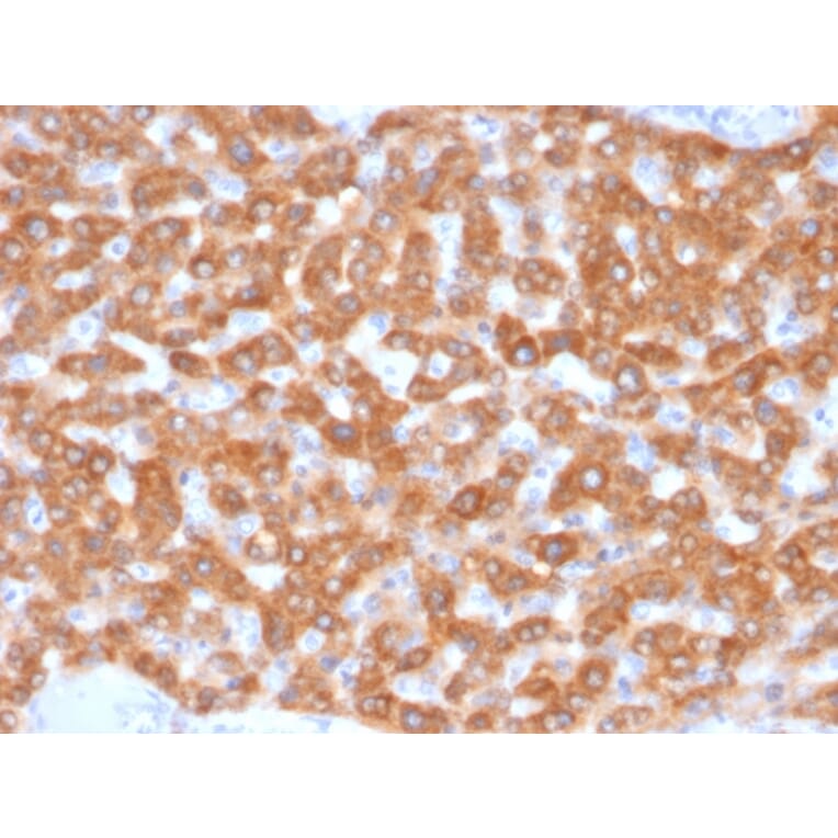 Immunohistochemistry - Anti-SDHB Antibody [SDHB/2126] - BSA and Azide free (A278378) - Antibodies.com