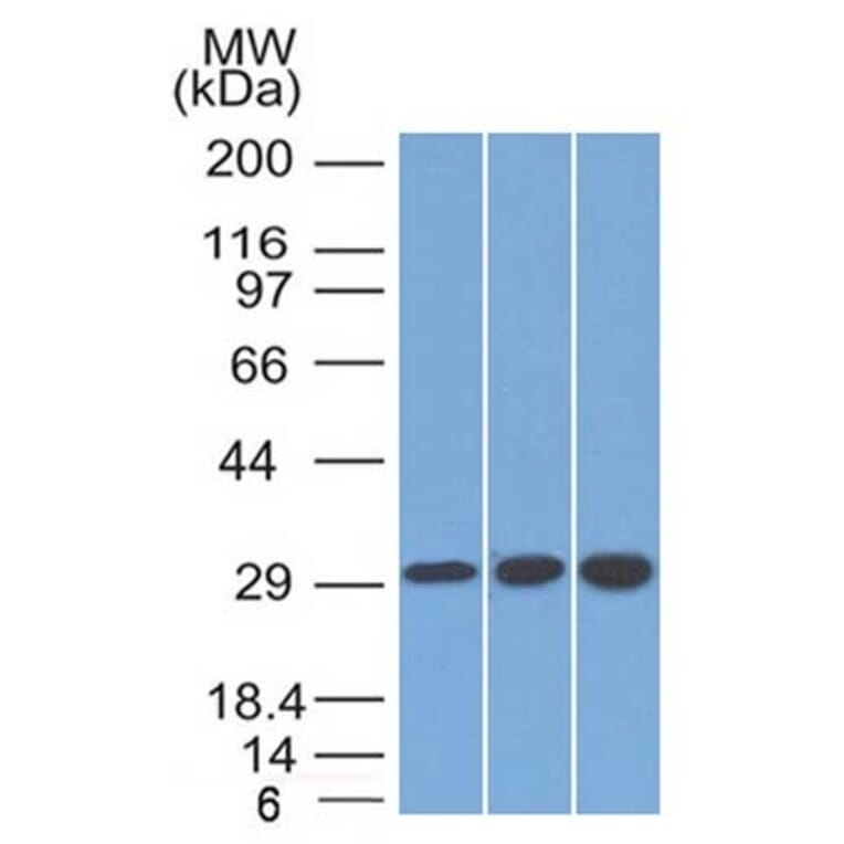 Western Blot - Anti-SDHB Antibody [SDHB/2126] - BSA and Azide free (A278378) - Antibodies.com