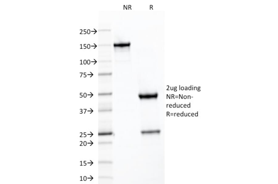 SDS-PAGE - Anti-SDHB Antibody [SDHB/2126] - BSA and Azide free (A278378) - Antibodies.com