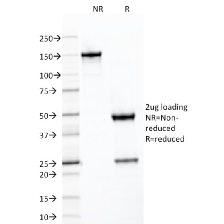 SDS-PAGE - Anti-SDHB Antibody [SDHB/2126] - BSA and Azide free (A278378) - Antibodies.com