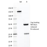 SDS-PAGE - Anti-SDHB Antibody [SDHB/2126] - BSA and Azide free (A278378) - Antibodies.com