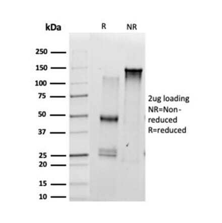 SDS-PAGE - Anti-SCXA Antibody [PCRP-SCXA-1D2] - BSA and Azide free (A278379) - Antibodies.com