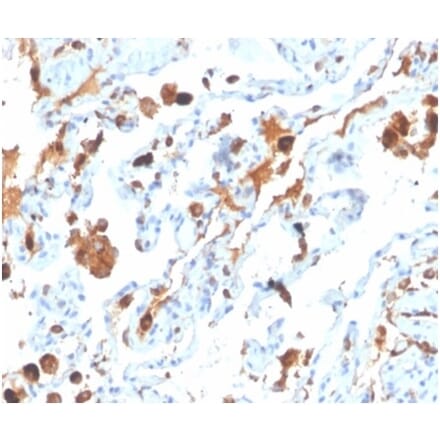 Immunohistochemistry - Anti-Surfactant Protein D Antibody [SFTPD/4363] - BSA and Azide free (A278380) - Antibodies.com