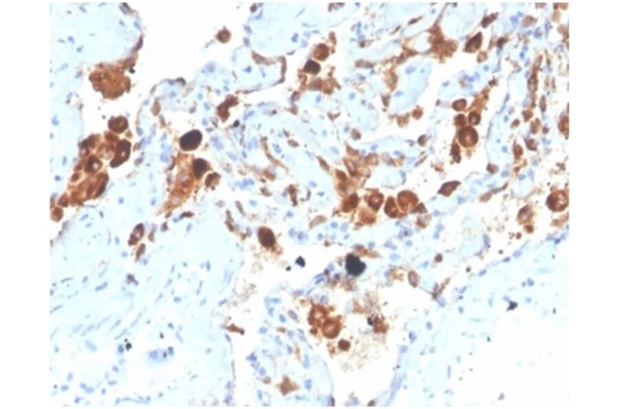Immunohistochemistry - Anti-Surfactant Protein D Antibody [SFTPD/4363] - BSA and Azide free (A278380) - Antibodies.com