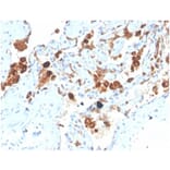 Immunohistochemistry - Anti-Surfactant Protein D Antibody [SFTPD/4363] - BSA and Azide free (A278380) - Antibodies.com