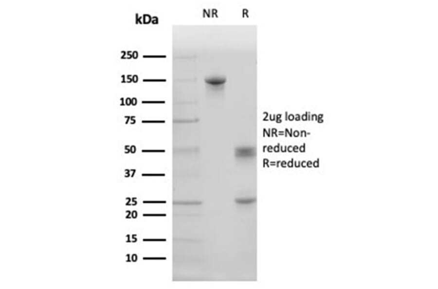 SDS-PAGE - Anti-Surfactant Protein D Antibody [SFTPD/4363] - BSA and Azide free (A278380) - Antibodies.com