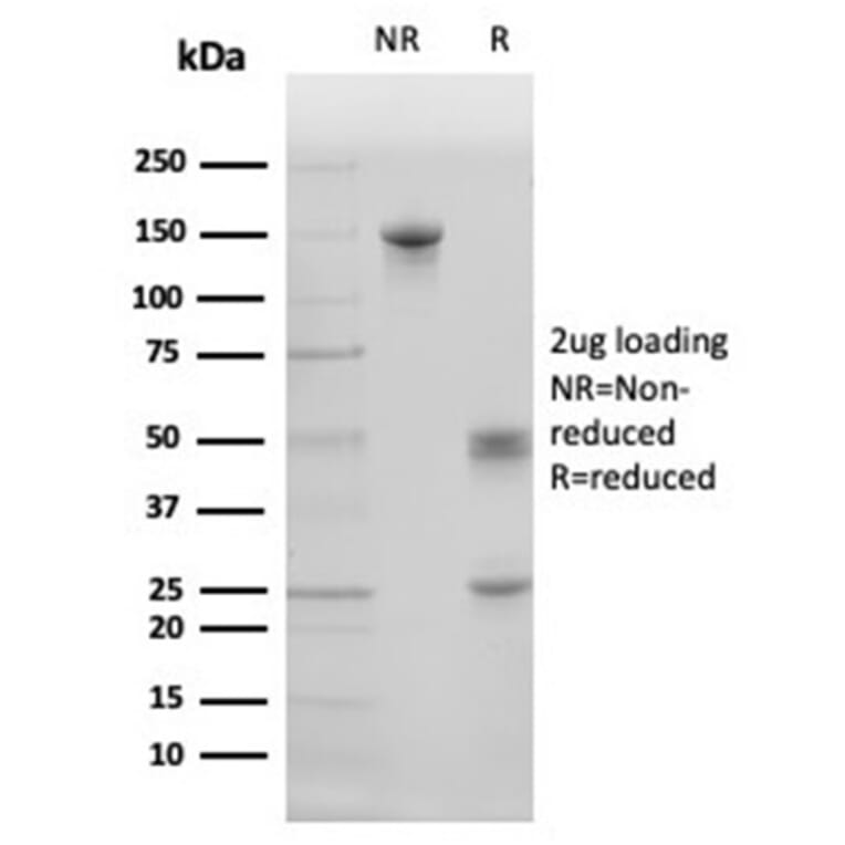 SDS-PAGE - Anti-Surfactant Protein D Antibody [SFTPD/4363] - BSA and Azide free (A278380) - Antibodies.com