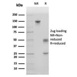 SDS-PAGE - Anti-Surfactant Protein D Antibody [SFTPD/4363] - BSA and Azide free (A278380) - Antibodies.com