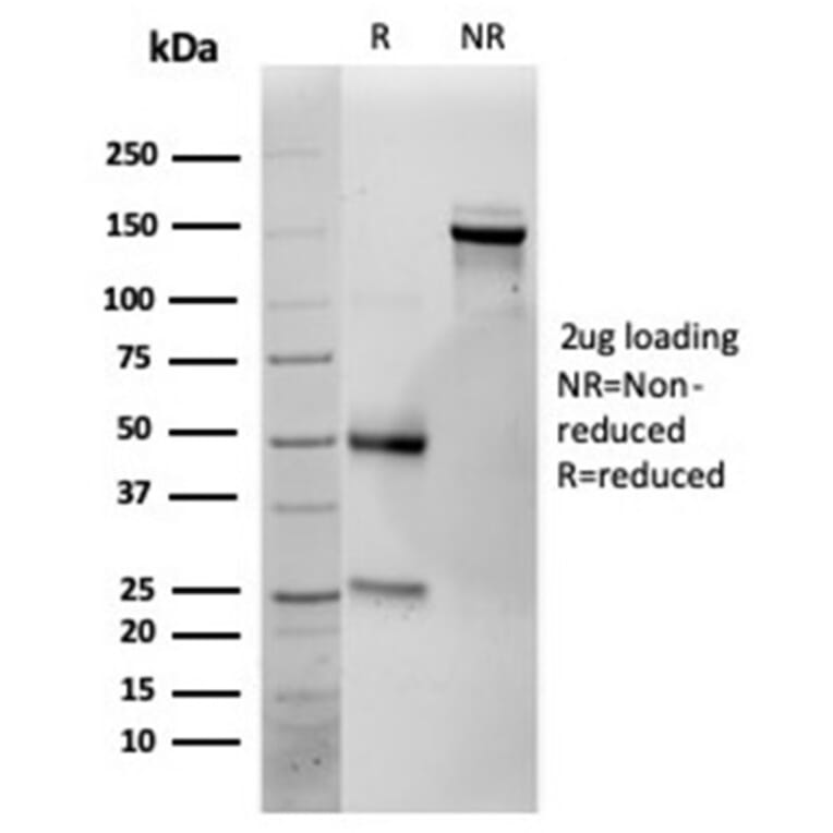 SDS-PAGE - Anti-IL-25 Antibody [IL25/625] - BSA and Azide free (A278381) - Antibodies.com