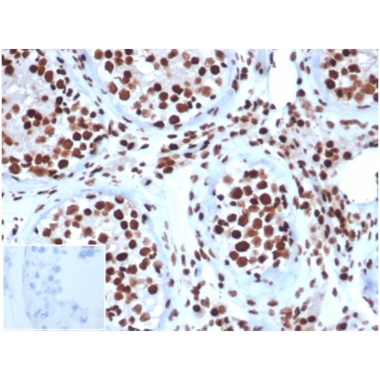 Immunohistochemistry - Anti-SNF5 Antibody [SMARCB1/3984] - BSA and Azide free (A278382) - Antibodies.com