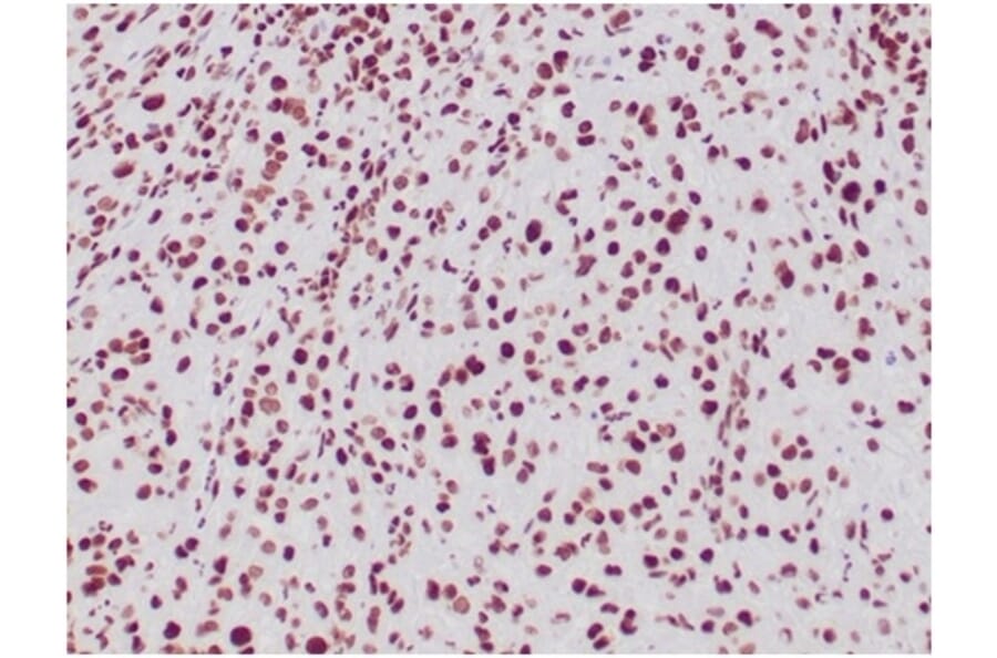 Immunohistochemistry - Anti-SNF5 Antibody [SMARCB1/3984] - BSA and Azide free (A278382) - Antibodies.com