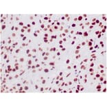 Immunohistochemistry - Anti-SNF5 Antibody [SMARCB1/3984] - BSA and Azide free (A278382) - Antibodies.com