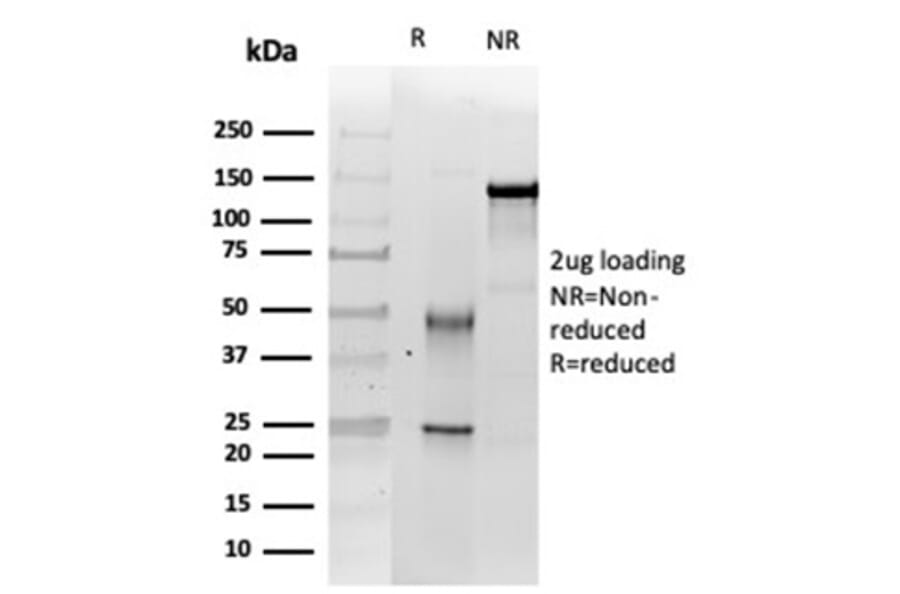 SDS-PAGE - Anti-SNF5 Antibody [SMARCB1/3984] - BSA and Azide free (A278382) - Antibodies.com