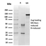 SDS-PAGE - Anti-SNF5 Antibody [SMARCB1/3984] - BSA and Azide free (A278382) - Antibodies.com