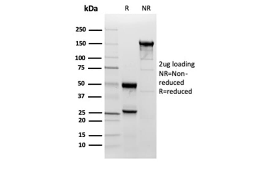 SDS-PAGE - Anti-Superoxide Dismutase 1 Antibody [SOD1/3923] - BSA and Azide free (A278383) - Antibodies.com
